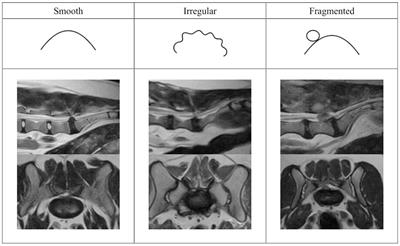 Accuracy of low-field magnetic resonance imaging for differentiating intervertebral disc extrusions and protrusions at the lumbosacral disc space in dogs
